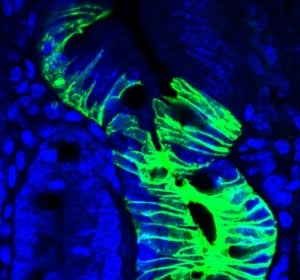 Celulas madre quiescentes en el intestino Celulas madre quiescentes en el intestino