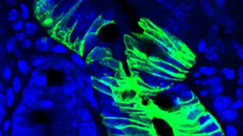 Celulas madre quiescentes en el intestino Celulas madre quiescentes en el intestino