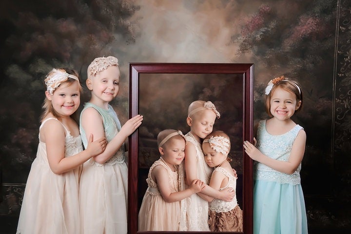 Tres niñas supervivientes del cáncer repiten la sesión de fotos que hicieron cuando estaban enfermas para reflejar su lucha Tres niñas supervivientes del cáncer repiten la sesión de fotos que hicieron cuando estaban enfermas para reflejar su lucha