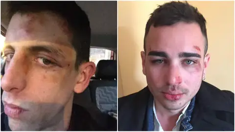 Agresión a dos homosexuales en Barcelona Agresión a dos homosexuales en Barcelona