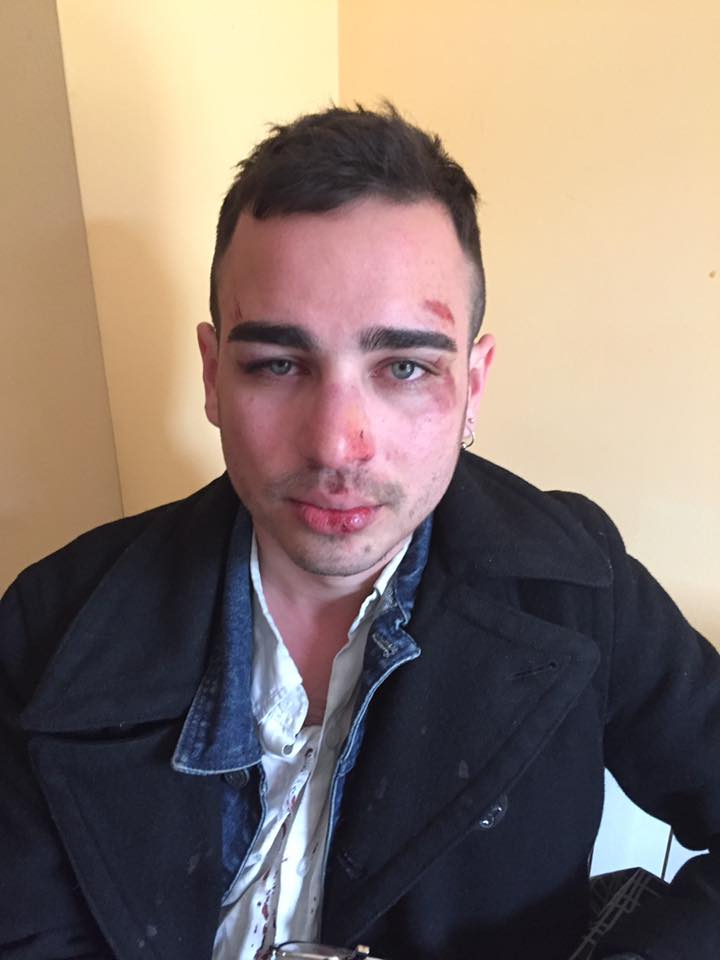 Agreden a dos chicos homosexuales en Barcelona por besarse en público Agreden a dos chicos homosexuales en Barcelona por besarse en público