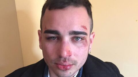 Una pareja homosexual agredida en Berga (Barcelona)