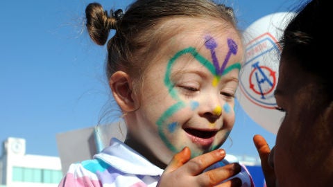 Ni&ntilde;a con S&iacute;ndrome de Down