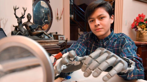  Leonardo Viscarra, el ni&ntilde;o que se fabric&oacute; su propia mano rob&oacute;tica