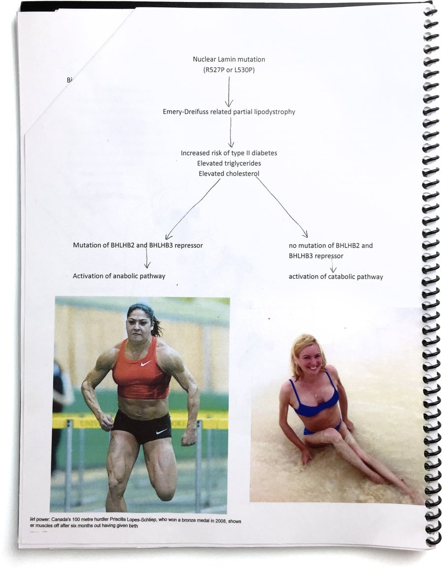 El Tintero: Lo que tienen en común una persona que sufre distrofia muscular y una atleta olímpica El Tintero: Lo que tienen en común una persona que sufre distrofia muscular y una atleta olímpica