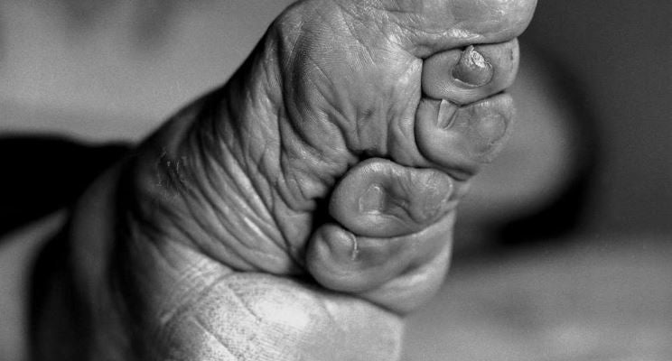 Podólogos de Extremadura aplauden la creación de su categoría profesional en el SES Podólogos de Extremadura aplauden la creación de su categoría profesional en el SES