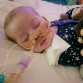 Charlie Gard, el bebé con una enfermedad rara que necesitaba dinero para tratarse en EEUU