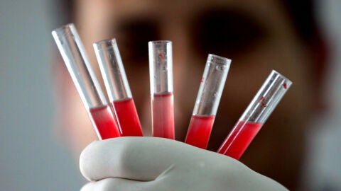 Creaci&oacute;n de gl&oacute;bulos rojos