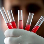 Creación de glóbulos rojos en una imagen de archivo