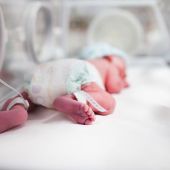 Imagen de archivo de un bebé prematuro en un centro hospitalario