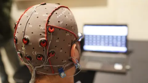 Estimulación cerebral con electrodos Estimulación cerebral con electrodos