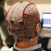 Estimulación cerebral con electrodos