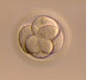 Existen varias razones por las que una mujer decide congelar sus óvulos Existen varias razones por las que una mujer decide congelar sus óvulos