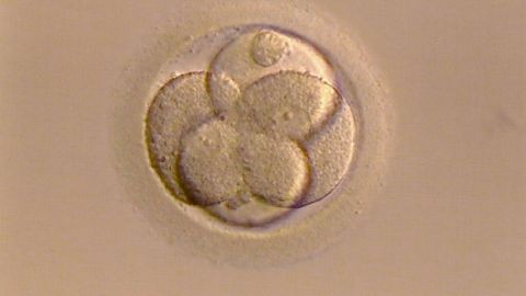 Existen varias razones por las que una mujer decide congelar sus &oacute;vulos