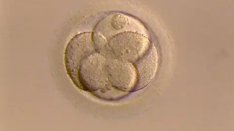 Existen varias razones por las que una mujer decide congelar sus óvulos Existen varias razones por las que una mujer decide congelar sus óvulos