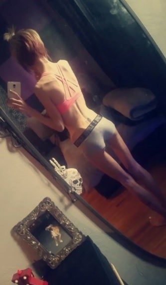 Un juzgado de Guadalajara condena al Sescam a abonar el tratamiento de una menor con anorexia Un juzgado de Guadalajara condena al Sescam a abonar el tratamiento de una menor con anorexia