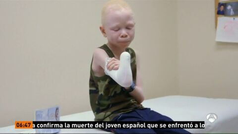 Frame 28.790798 de: ALBINOS