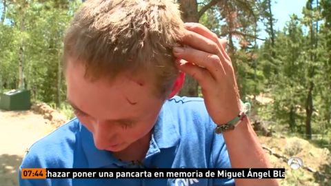 Un joven es atacado por un oso en EEUU