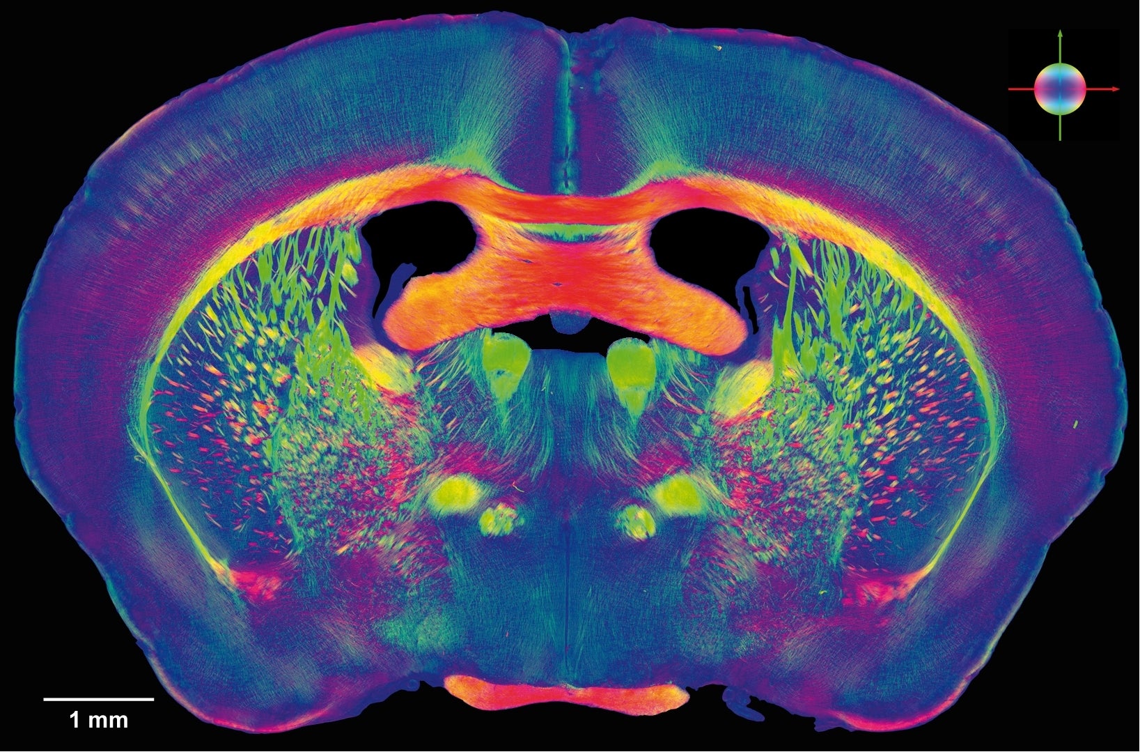 Doctor Juan Domingo Gispert: "Personas sanas pero susceptibles de tener Alzheimer muestran cambios anatómicos en el cerebro" Doctor Juan Domingo Gispert: "Personas sanas pero susceptibles de tener Alzheimer muestran cambios anatómicos en el cerebro"