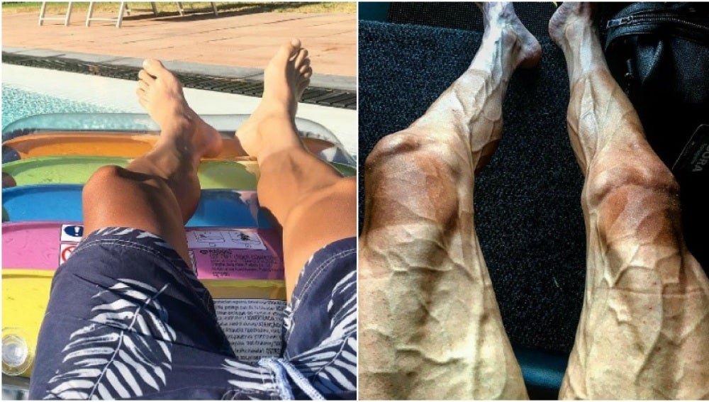 Contraste de las piernas de Pawel Poljanski