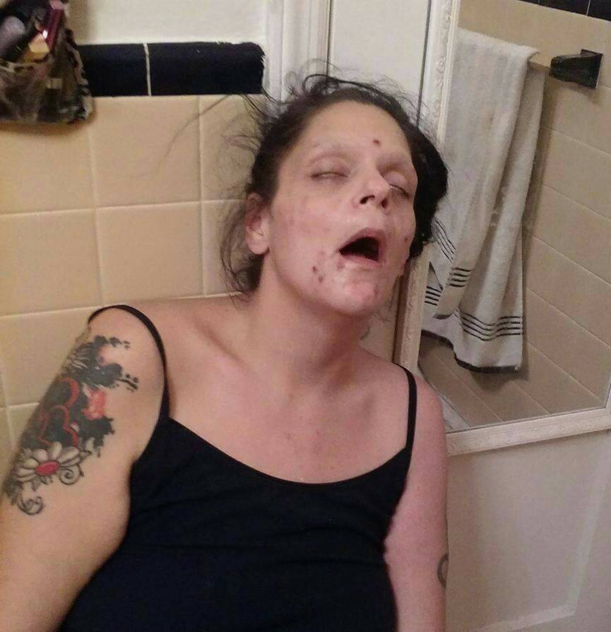 Una exadicta a la heroína publica fotografías en las redes para concienciar sobre los horrores de la adicción a las drogas Una exadicta a la heroína publica fotografías en las redes para concienciar sobre los horrores de la adicción a las drogas