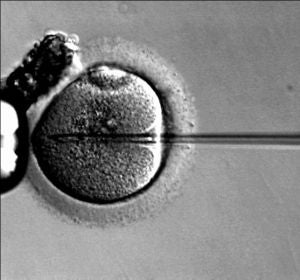 Fecundación in vitro Fecundación in vitro