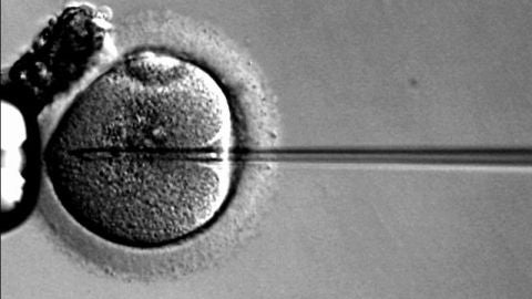 Fecundaci&oacute;n in vitro