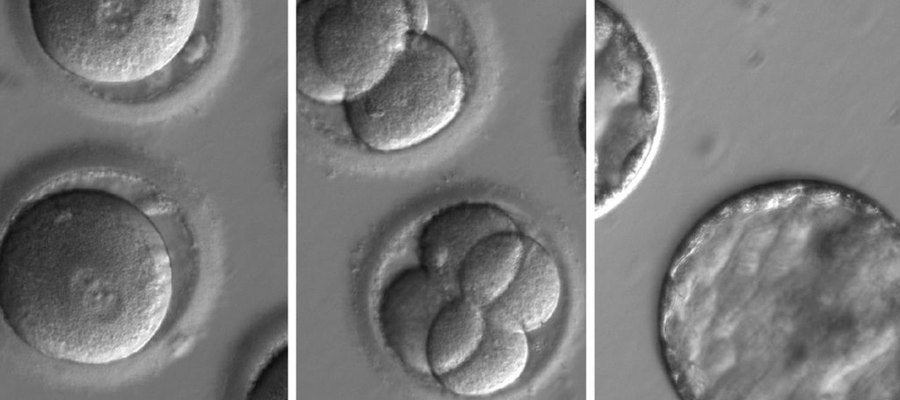 Embriones humanos a los que se aplicó la técnica CRISPR Embriones humanos a los que se aplicó la técnica CRISPR