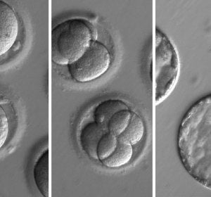 Embriones humanos a los que se aplicó la técnica CRISPR Embriones humanos a los que se aplicó la técnica CRISPR