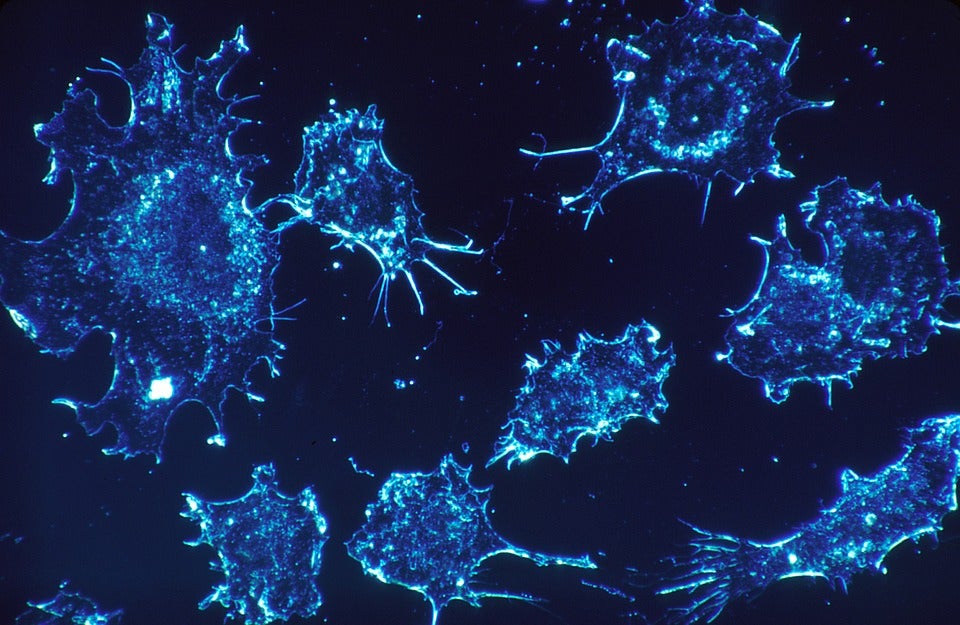 Los oncólogos fijan 2025 como el año en que empezarán a bajar los casos de cáncer Los oncólogos fijan 2025 como el año en que empezarán a bajar los casos de cáncer