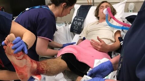 El adolescente, ingresado por la gravedad de las heridas