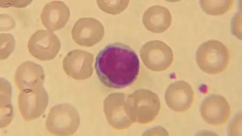 Crean un nuevo método para proteger al cuerpo de enfermedades autoinmunes Crean un nuevo método para proteger al cuerpo de enfermedades autoinmunes