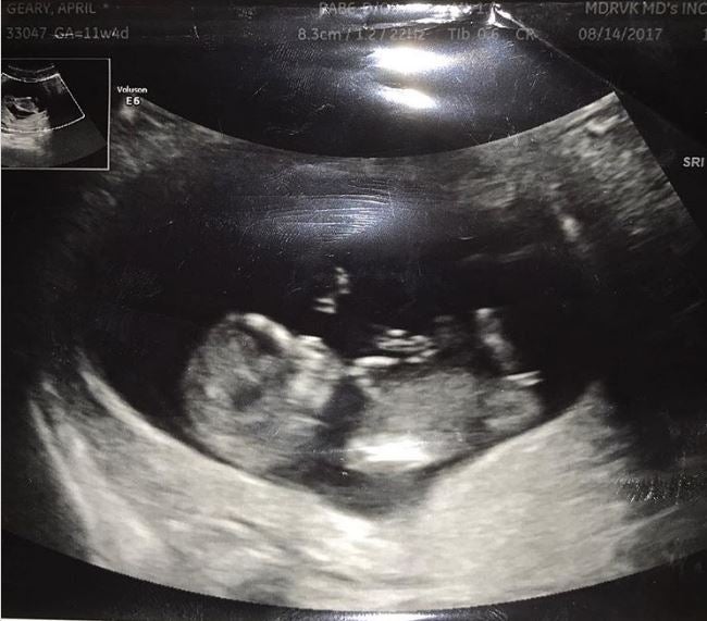 Com afecta al fetus el consum d'alcohol per part dels seus pares? Com afecta al fetus el consum d'alcohol per part dels seus pares?