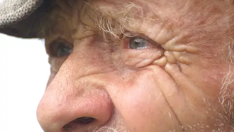El Alzheimer se podría detectar a través de los ojos El Alzheimer se podría detectar a través de los ojos