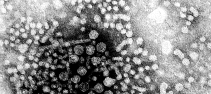 Hepatitis A Hepatitis A