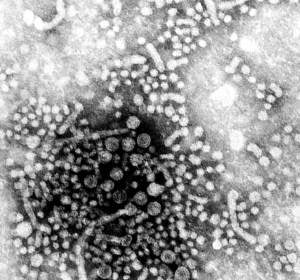 Hepatitis A Hepatitis A