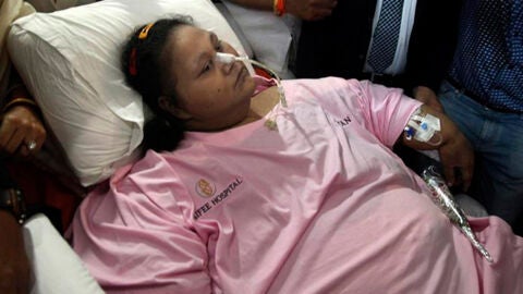 Eman Ahmed Abd El Aty, la egipcia que lleg&oacute; a pesar 500 kilos