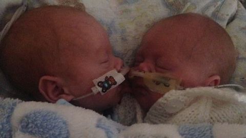 Los beb&eacute;s prematuros que mejoraron al estar cerca el uno del otro