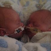 Los bebés prematuros que mejoraron al estar cerca el uno del otro