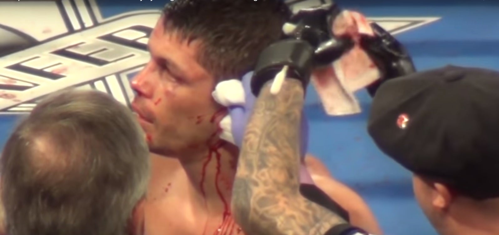 Duras imágenes: le parten la oreja a un boxeador en un combate en Las Vegas Duras imágenes: le parten la oreja a un boxeador en un combate en Las Vegas
