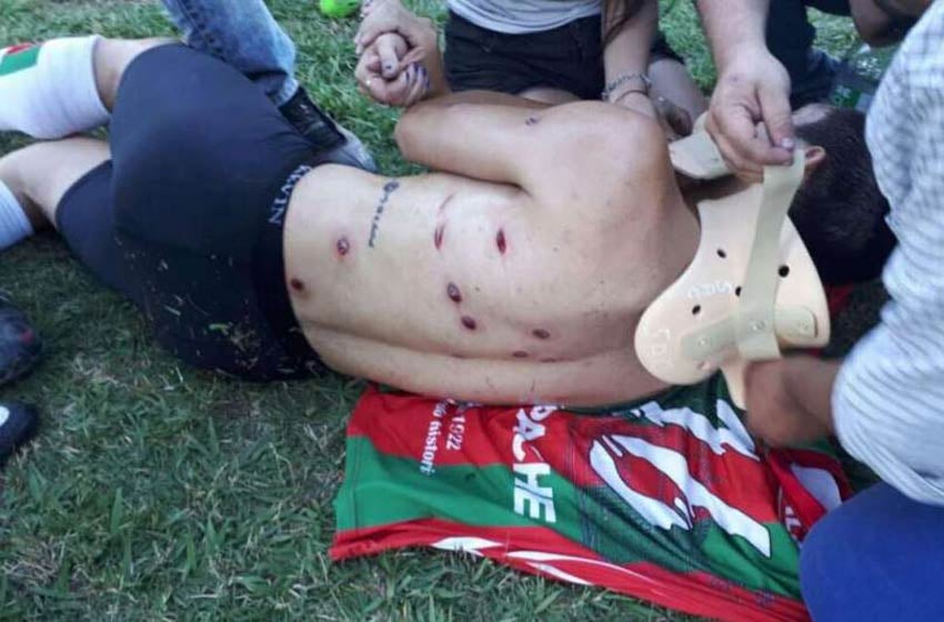 Polémica en Argentina: La policía dispara a jugadores y aficionados al terminar un partido de fútbol Polémica en Argentina: La policía dispara a jugadores y aficionados al terminar un partido de fútbol