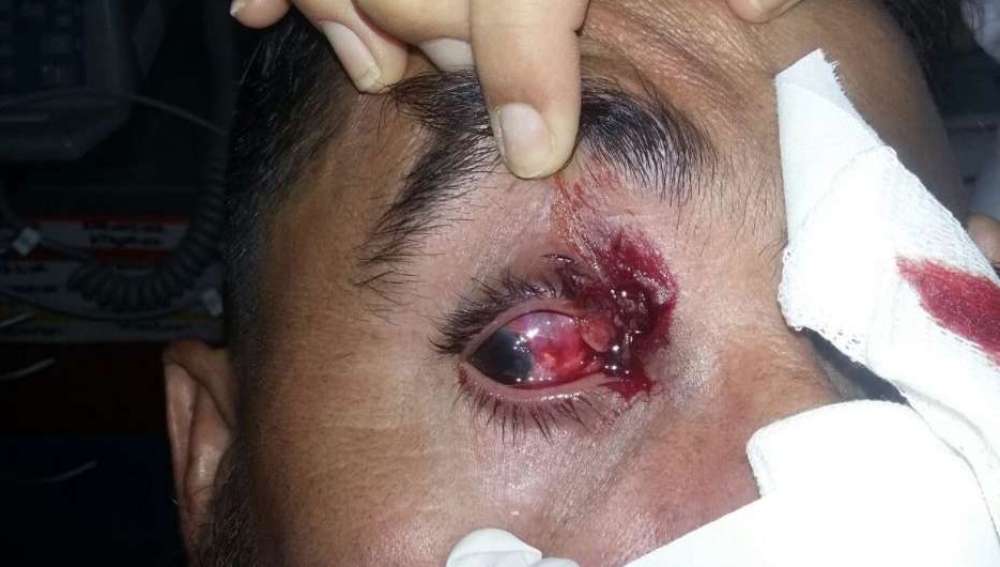 Así quedó el ojo de uno de los jugadores