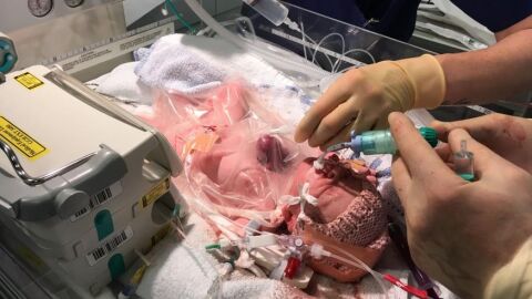 El nacimiento de la ni&ntilde;a con el coraz&oacute;n fuera