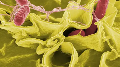 Salmonela La salmonela causo una de las epidemias mas devastadoras del siglo XVI en Mexico