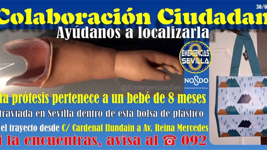 Pide ayuda para encontrar la pr&oacute;tesis de su beb&eacute; de ocho meses