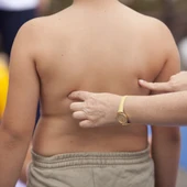 Investigación de la influencia genética en la obesidad infantil (foto cedida por 'Precipita') Investigación de la influencia genética en la obesidad infantil (foto cedida por 'Precipita')