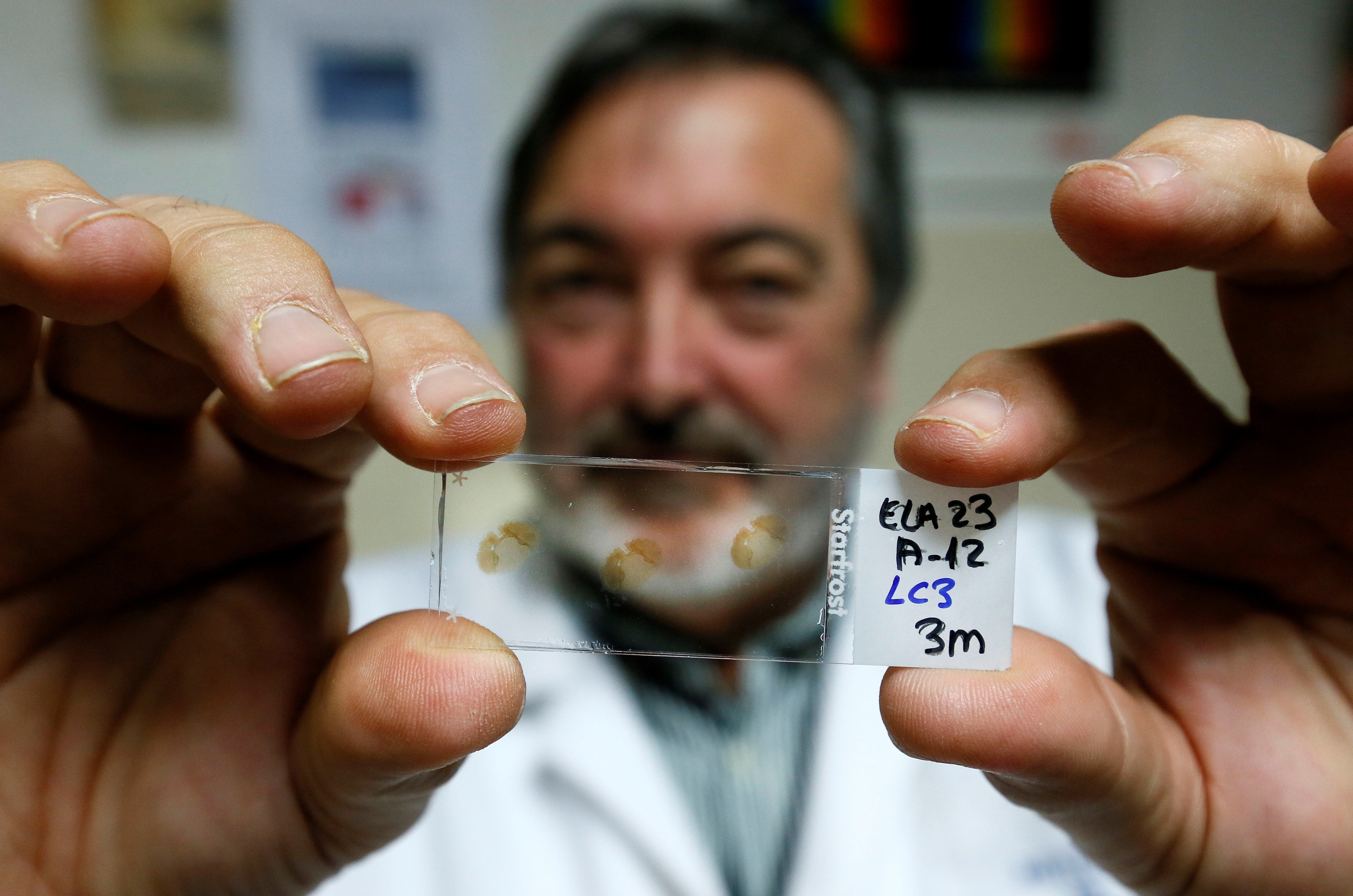 El Instituto de Neurociencias de la UMH obtiene 300.000 euros para seguir investigando en torno a la ELA El Instituto de Neurociencias de la UMH obtiene 300.000 euros para seguir investigando en torno a la ELA