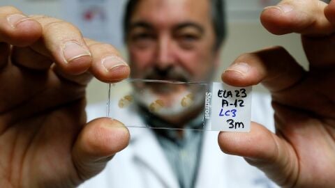 El director del departamento de Neurociencias, Salvador Mart&iacute;nez, muestra una placa con muestras de m&eacute;dula espinal enferma de ELA