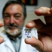 El director del departamento de Neurociencias, Salvador Martínez, muestra una placa con muestras de médula espinal enferma de ELA