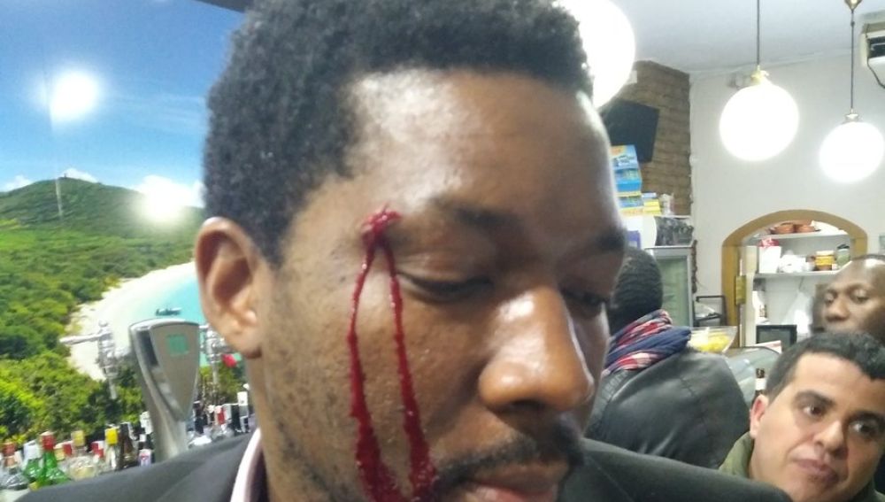 El actor muestra un corte en la ceja tras el ataque racista en Madrid